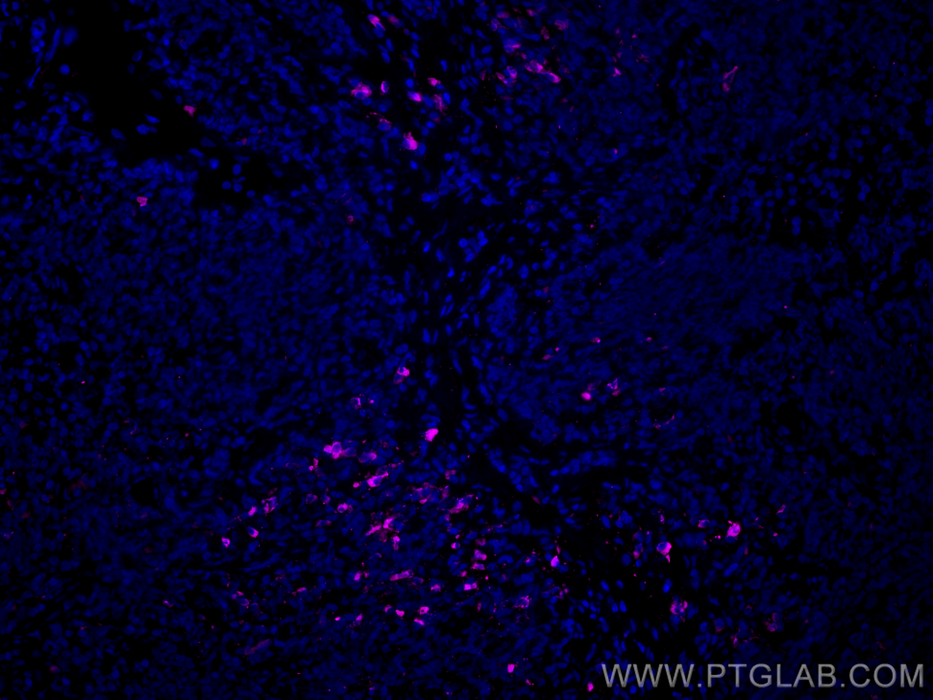 Immunofluorescence (IF) / fluorescent staining of human tonsillitis tissue using CoraLite® Plus 647-conjugated Human IgG4 Monoclona (CL647-66408)