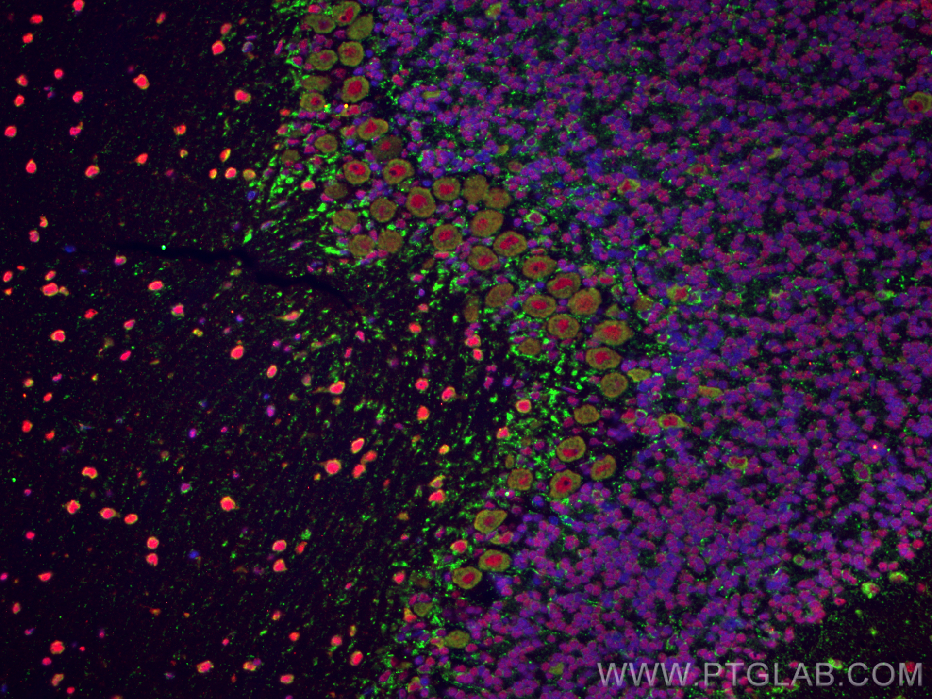 Immunofluorescence (IF) / fluorescent staining of rat cerebellum tissue using Huntingtin Polyclonal antibody (27206-1-AP)