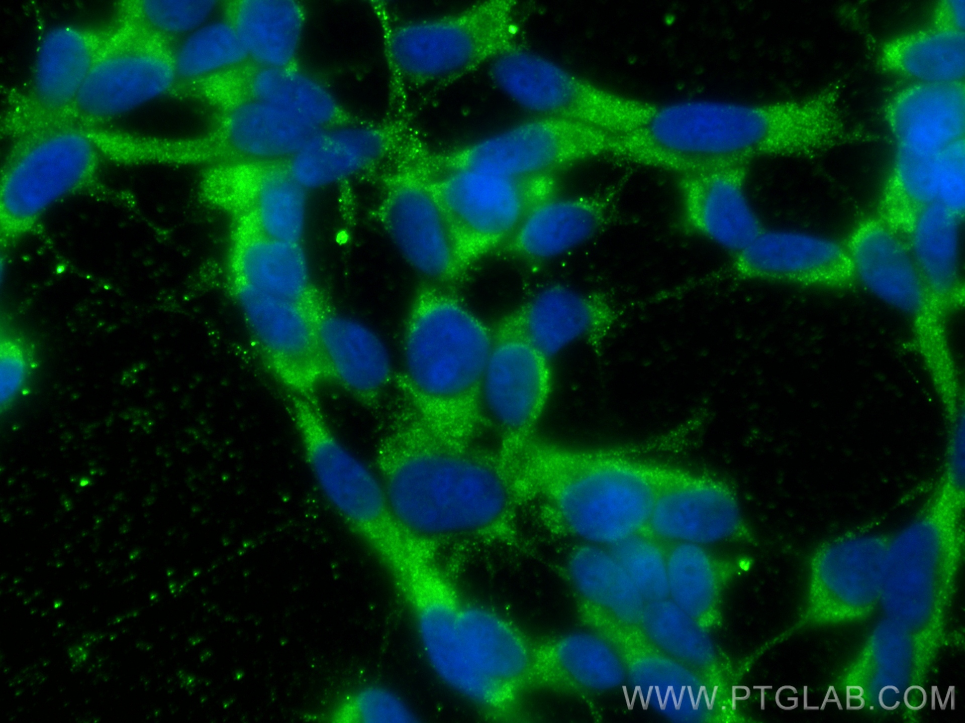 Immunofluorescence (IF) / fluorescent staining of SH-SY5Y cells using Huntingtin Monoclonal antibody (66553-1-Ig)