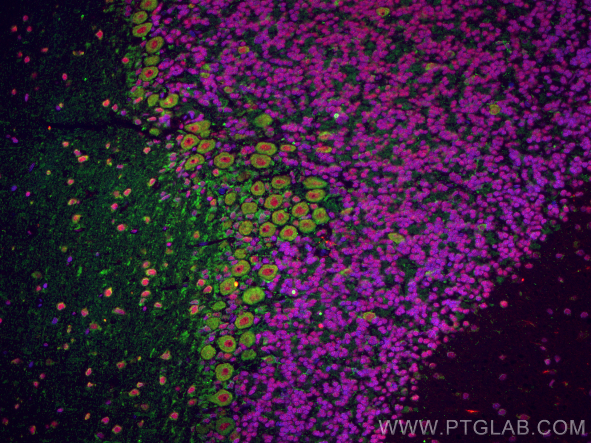 Immunofluorescence (IF) / fluorescent staining of rat cerebellum tissue using Huntingtin Monoclonal antibody (66553-1-Ig)