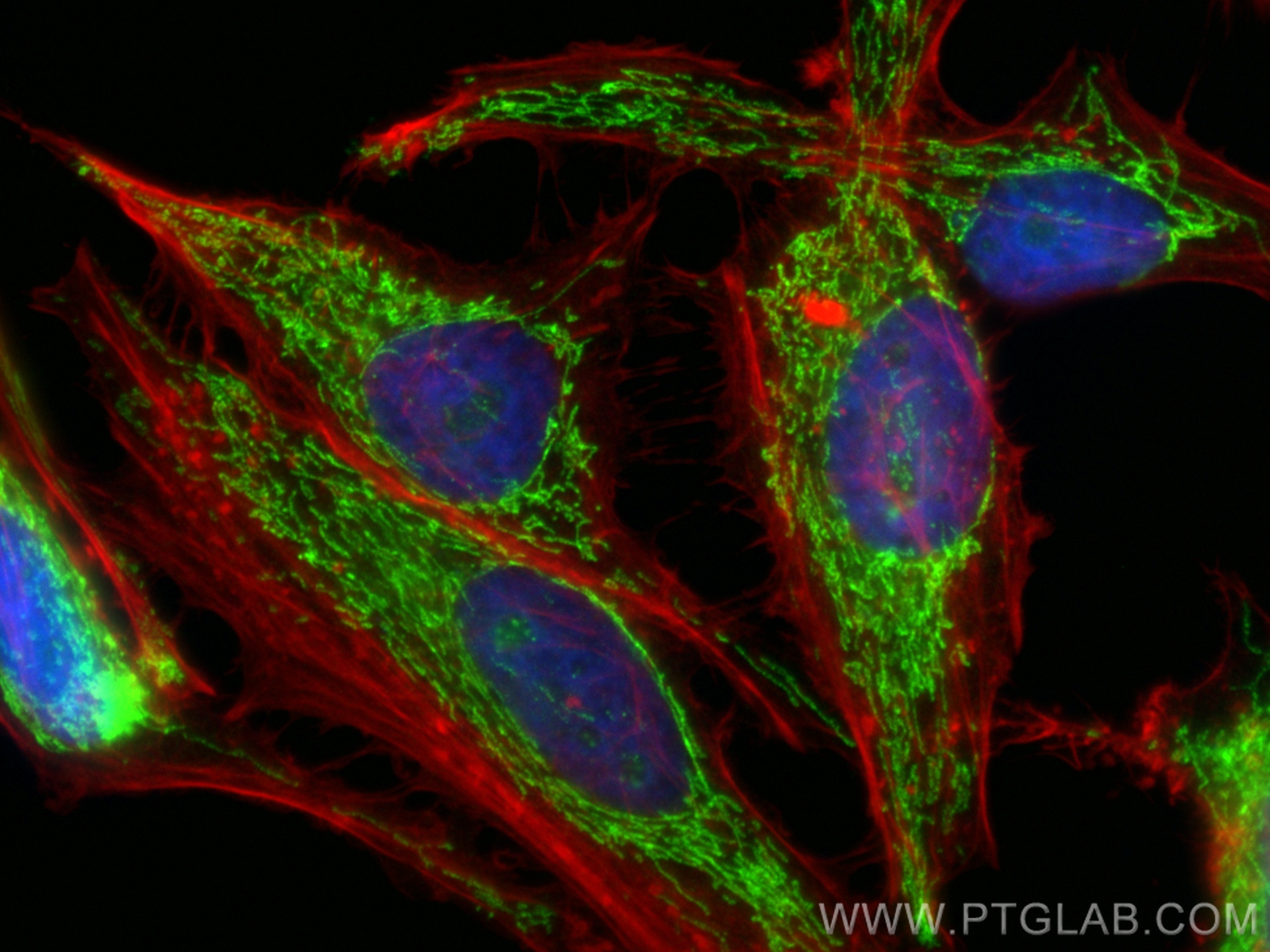 Immunofluorescence (IF) / fluorescent staining of HeLa cells using IARS2 Recombinant antibody (84764-3-RR)