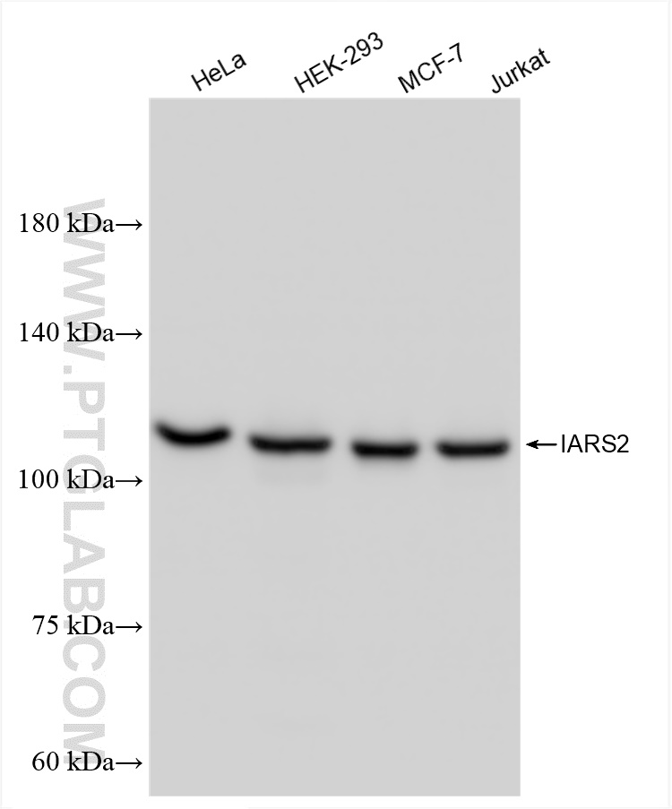 Western Blot (WB) analysis of various lysates using IARS2 Recombinant antibody (84764-3-RR)