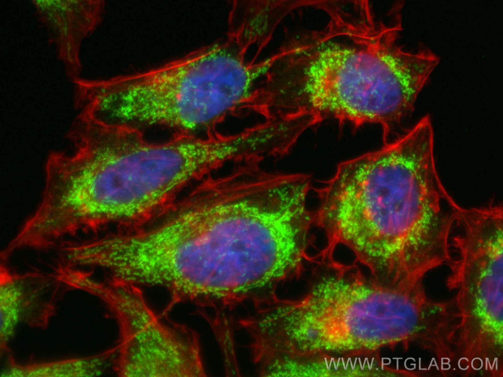 Immunofluorescence (IF) / fluorescent staining of HeLa cells using IARS2 Recombinant antibody (84764-5-RR)