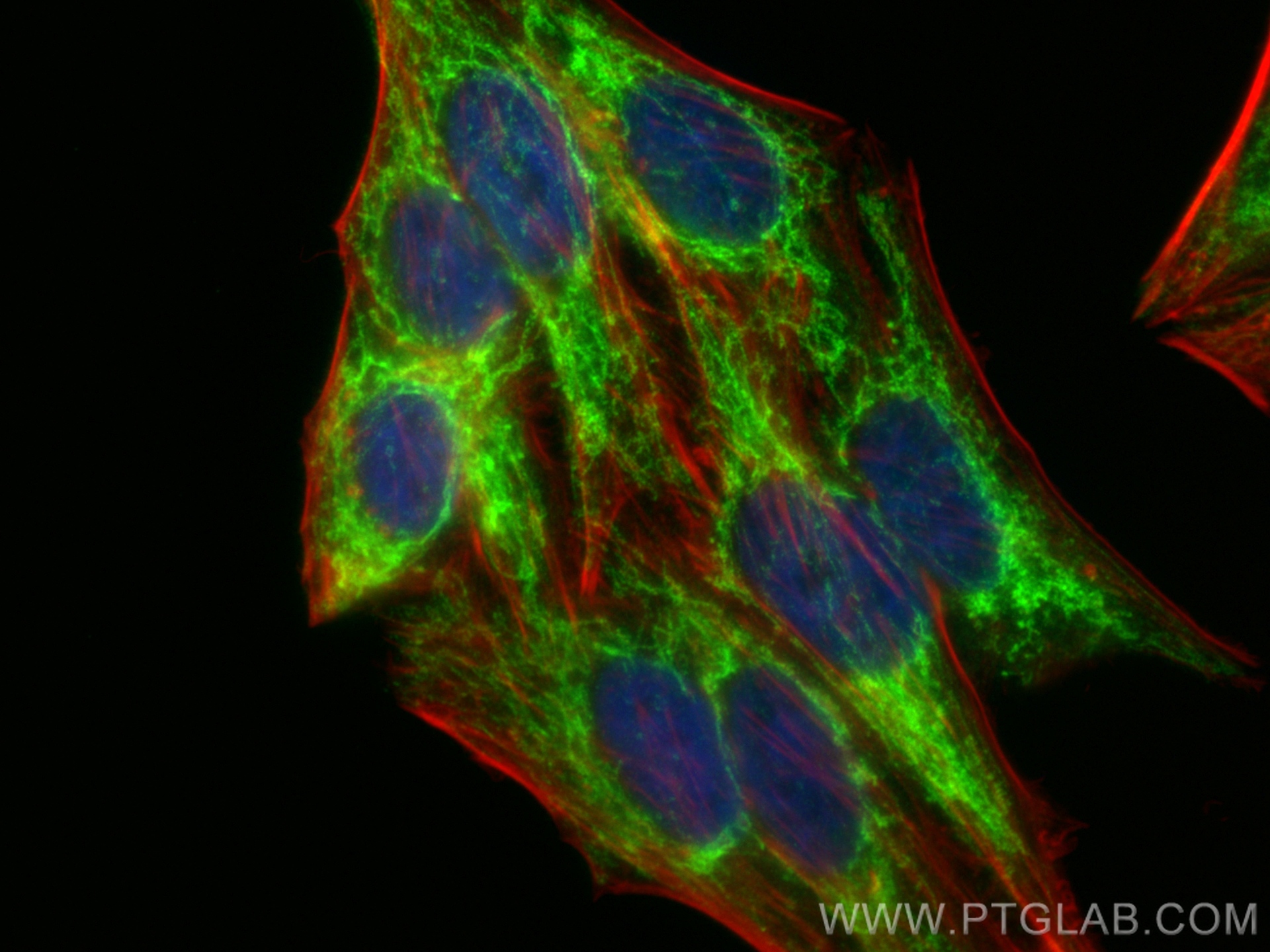 Immunofluorescence (IF) / fluorescent staining of HepG2 cells using IARS2 Recombinant antibody (84764-5-RR)