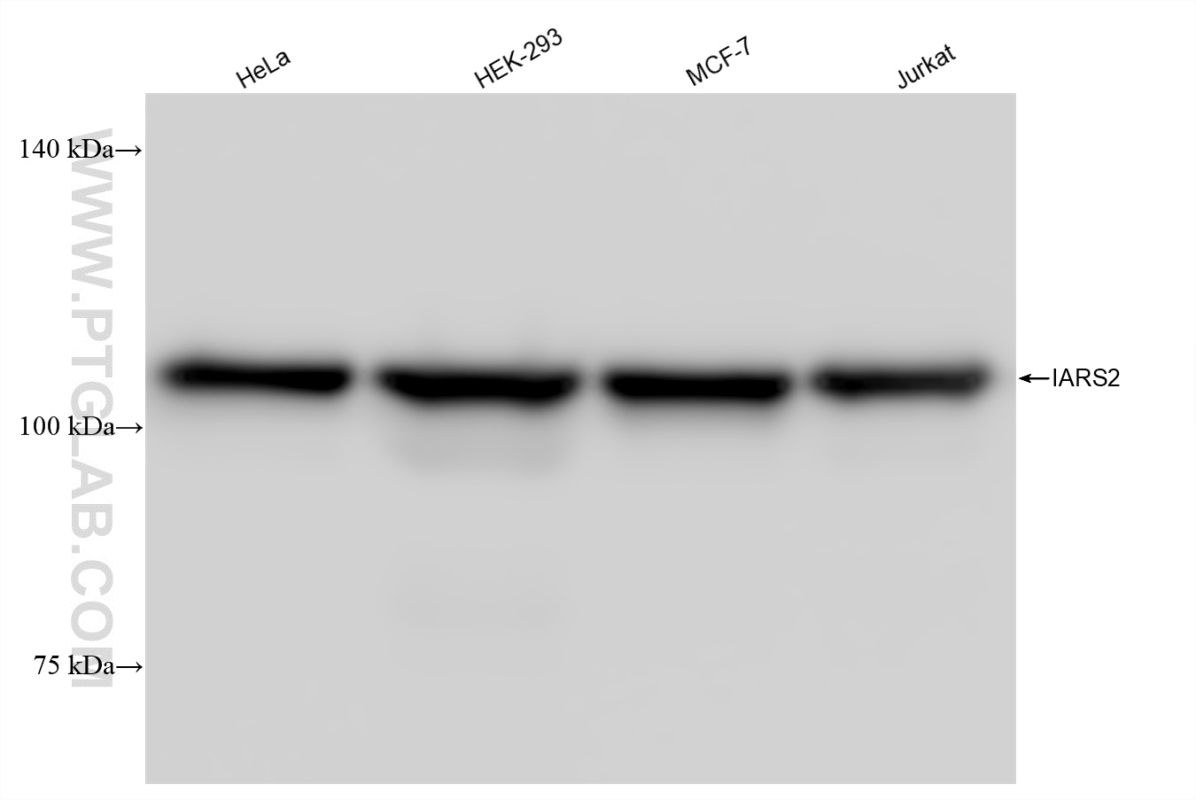 Western Blot (WB) analysis of various lysates using IARS2 Recombinant antibody (84764-5-RR)