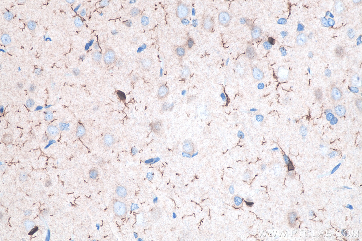 Immunohistochemistry (IHC) staining of rat brain tissue using IBA1 Polyclonal antibody (10904-1-AP)