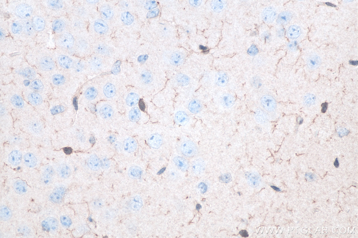 Immunohistochemistry (IHC) staining of mouse brain tissue using IBA1 Polyclonal antibody (10904-1-AP)