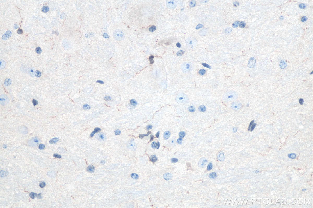 Immunohistochemistry (IHC) staining of mouse cerebellum tissue using IBA1 Polyclonal antibody (10904-1-AP)