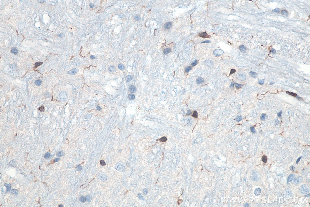 Immunohistochemistry (IHC) staining of rat cerebellum tissue using IBA1 Polyclonal antibody (10904-1-AP)