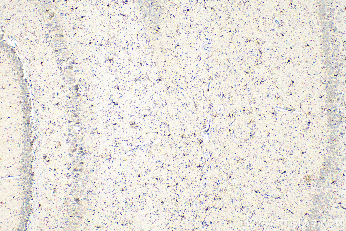 Immunohistochemistry (IHC) staining of rat brain tissue using IBA1 Polyclonal antibody (10904-1-AP)