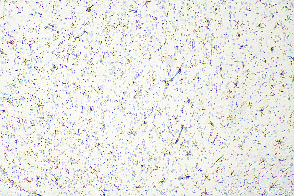 Immunohistochemistry (IHC) staining of rat brain tissue using IBA1 Polyclonal antibody (10904-1-AP)