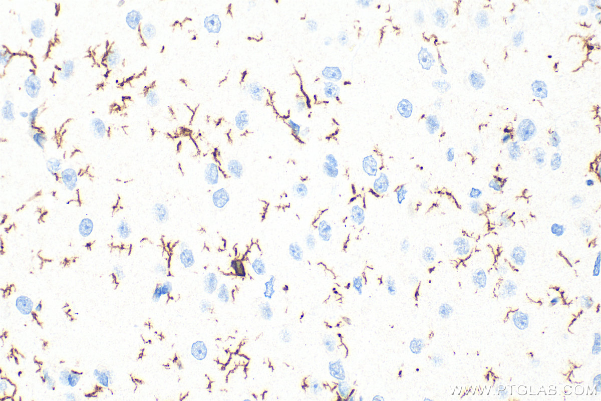 Immunohistochemistry (IHC) staining of rat brain tissue using IBA1 Polyclonal antibody (10904-1-AP)