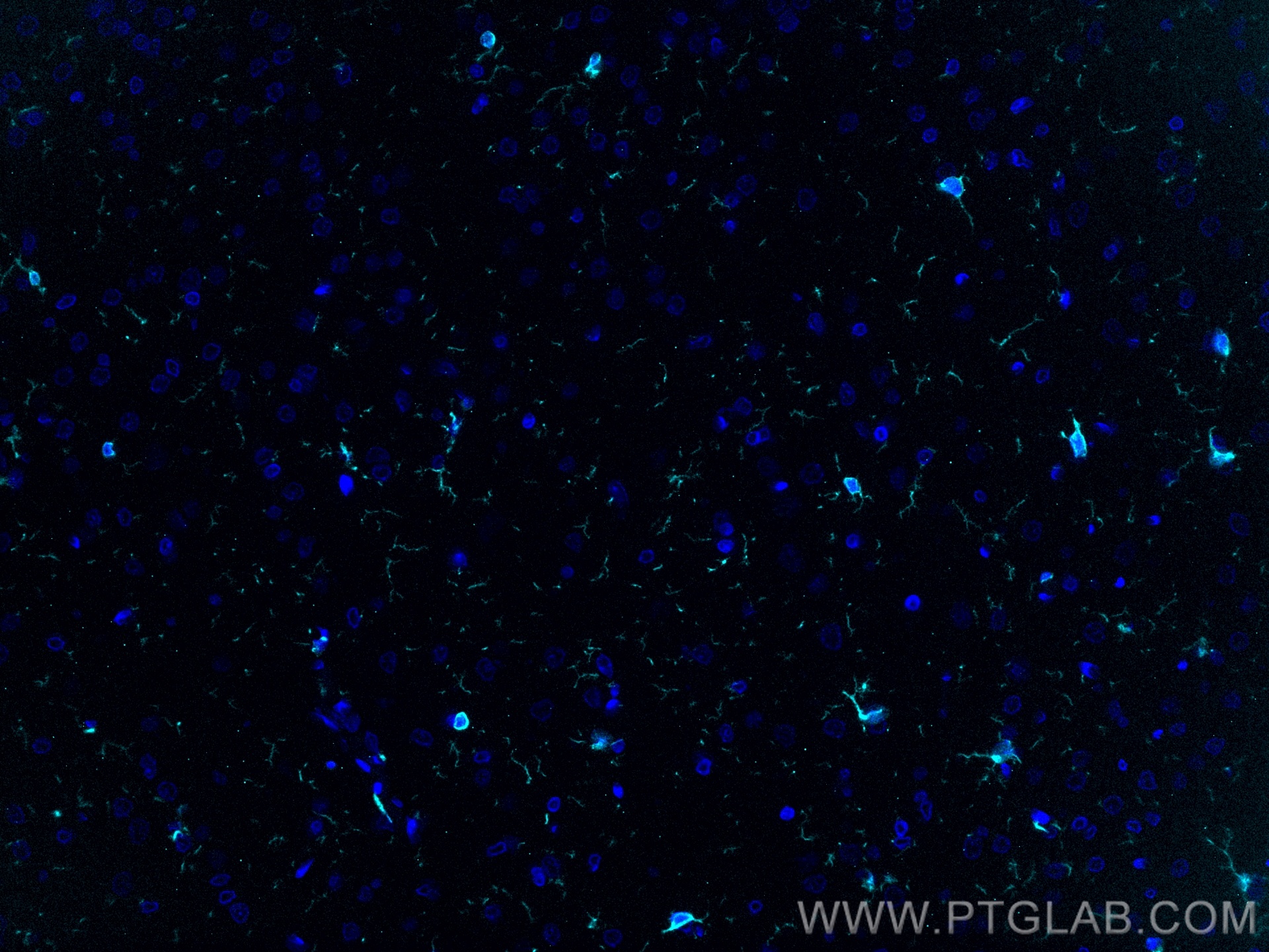 Immunofluorescence (IF) / fluorescent staining of rat brain tissue using IBA1 Recombinant antibody (81728-1-RR)