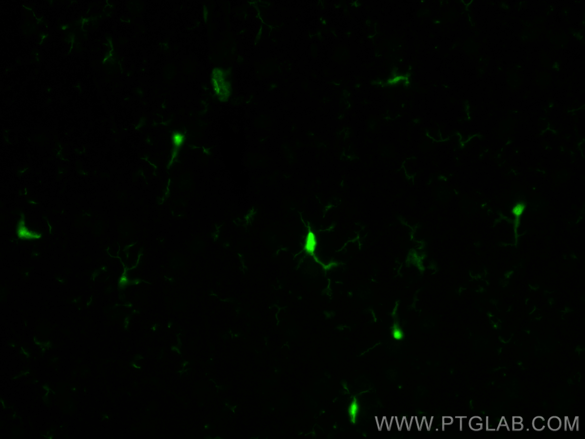 Immunofluorescence (IF) / fluorescent staining of rat brain tissue using IBA1 Recombinant antibody (81728-1-RR)