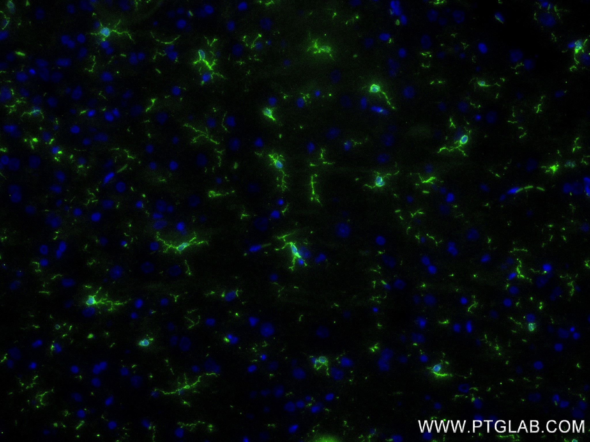 Immunofluorescence (IF) / fluorescent staining of rat brain tissue using IBA1 Recombinant antibody (81728-1-RR)