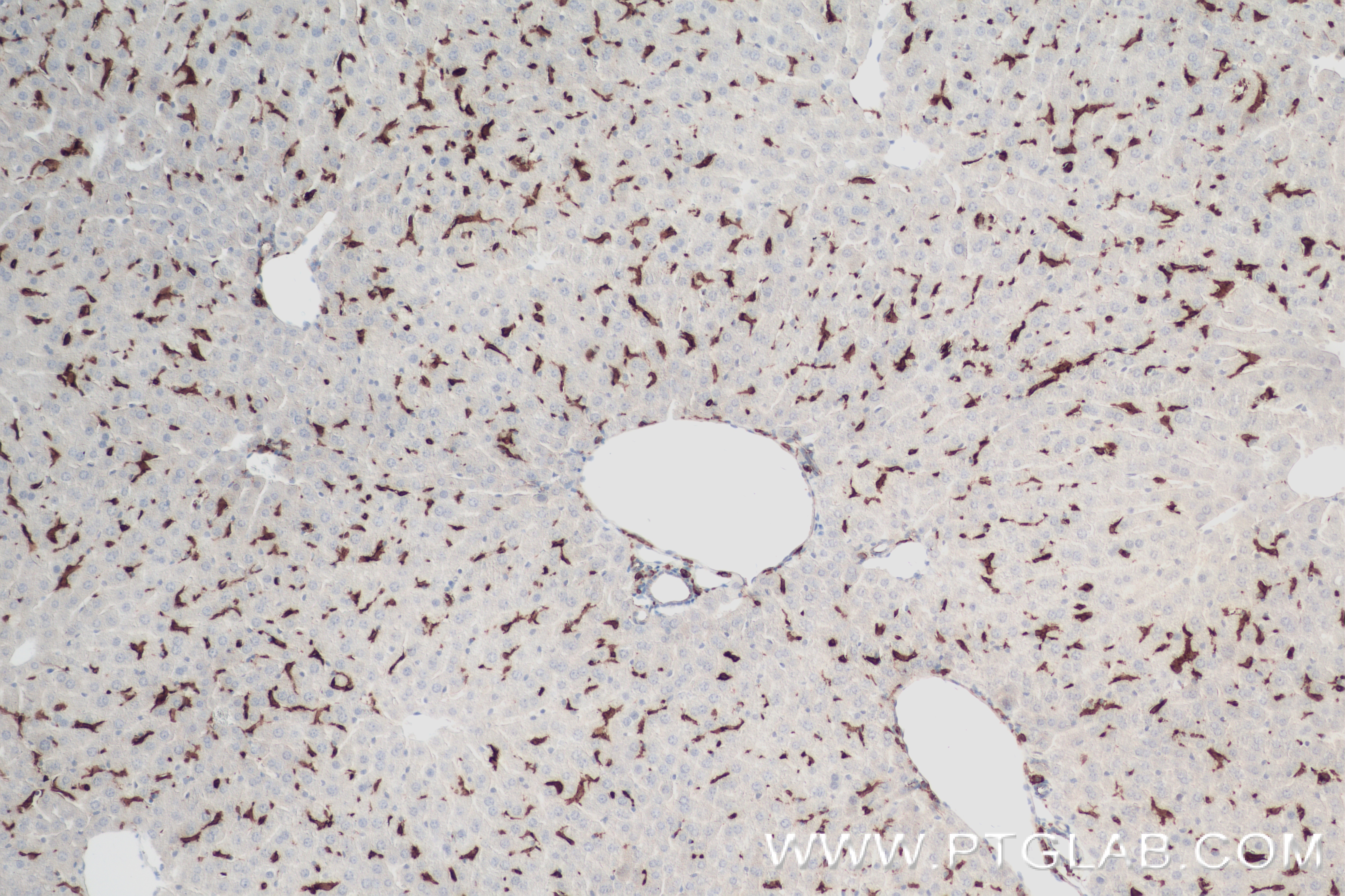 Immunohistochemistry (IHC) staining of mouse liver tissue using IBA1 Recombinant antibody (81728-1-RR)