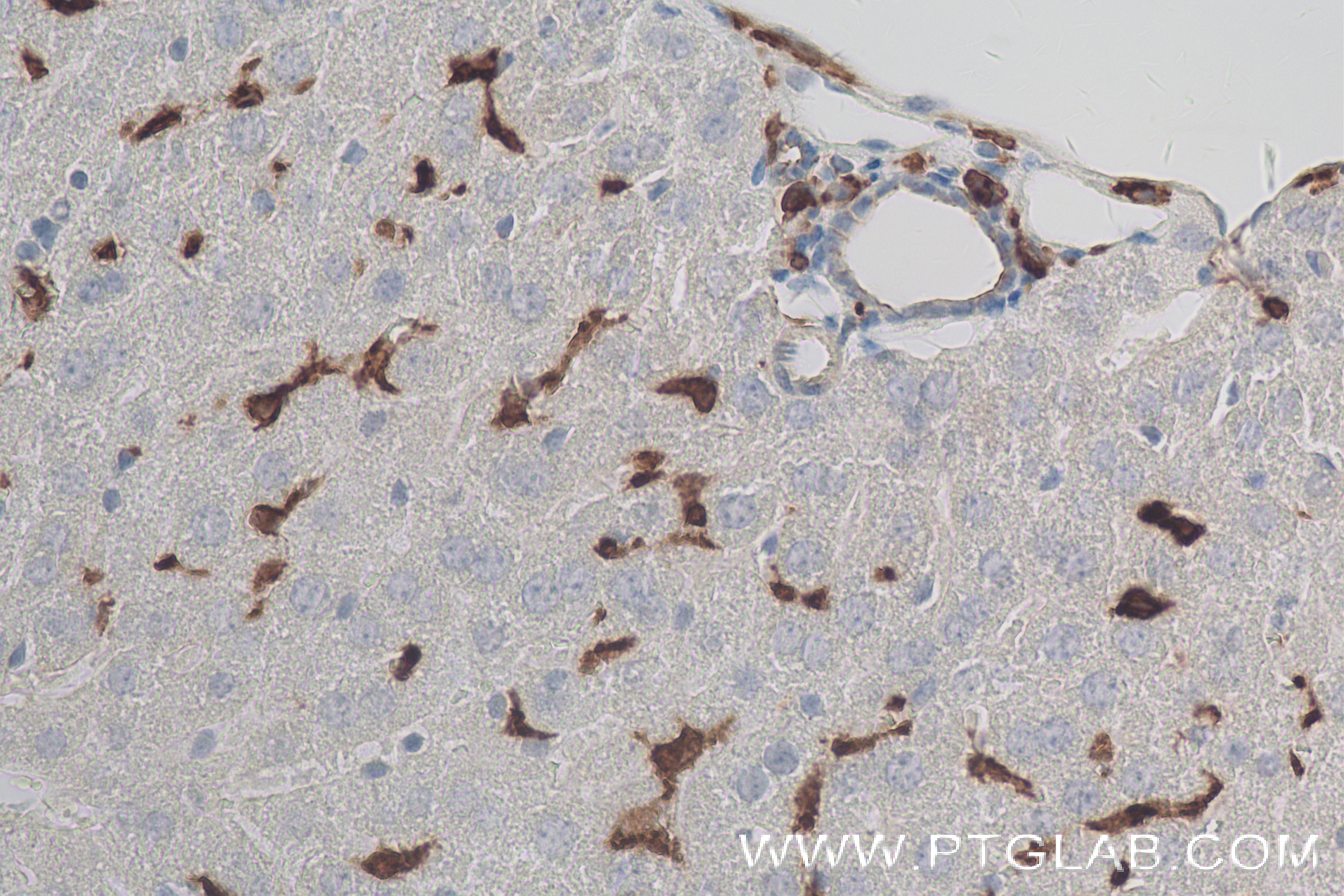 Immunohistochemistry (IHC) staining of mouse liver tissue using IBA1 Recombinant antibody (81728-1-RR)