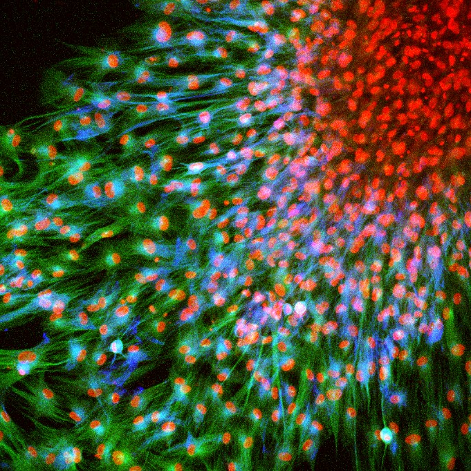 Immunofluorescence (IF) / fluorescent staining of human dental pulp stem cells using CoraLite®594-conjugated IBA1 Polyclonal antibody (CL594-10904)