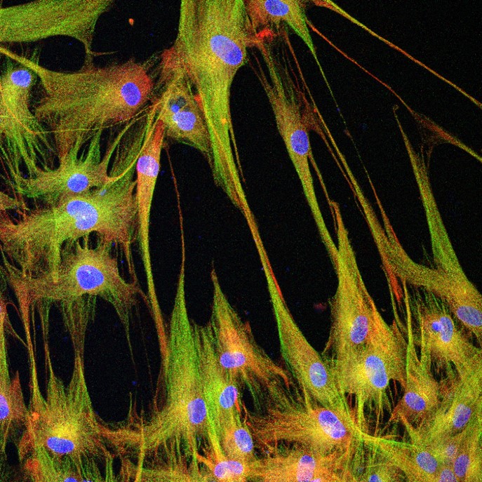 Immunofluorescence (IF) / fluorescent staining of human dental pulp stem cells using CoraLite®594-conjugated IBA1 Polyclonal antibody (CL594-10904)