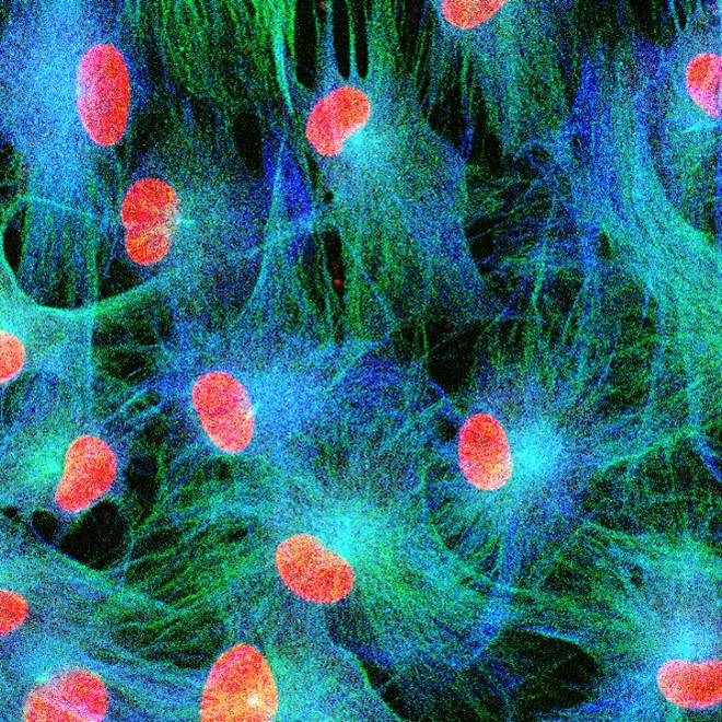 Immunofluorescence (IF) / fluorescent staining of human dental pulp stem cells using CoraLite®594-conjugated IBA1 Polyclonal antibody (CL594-10904)