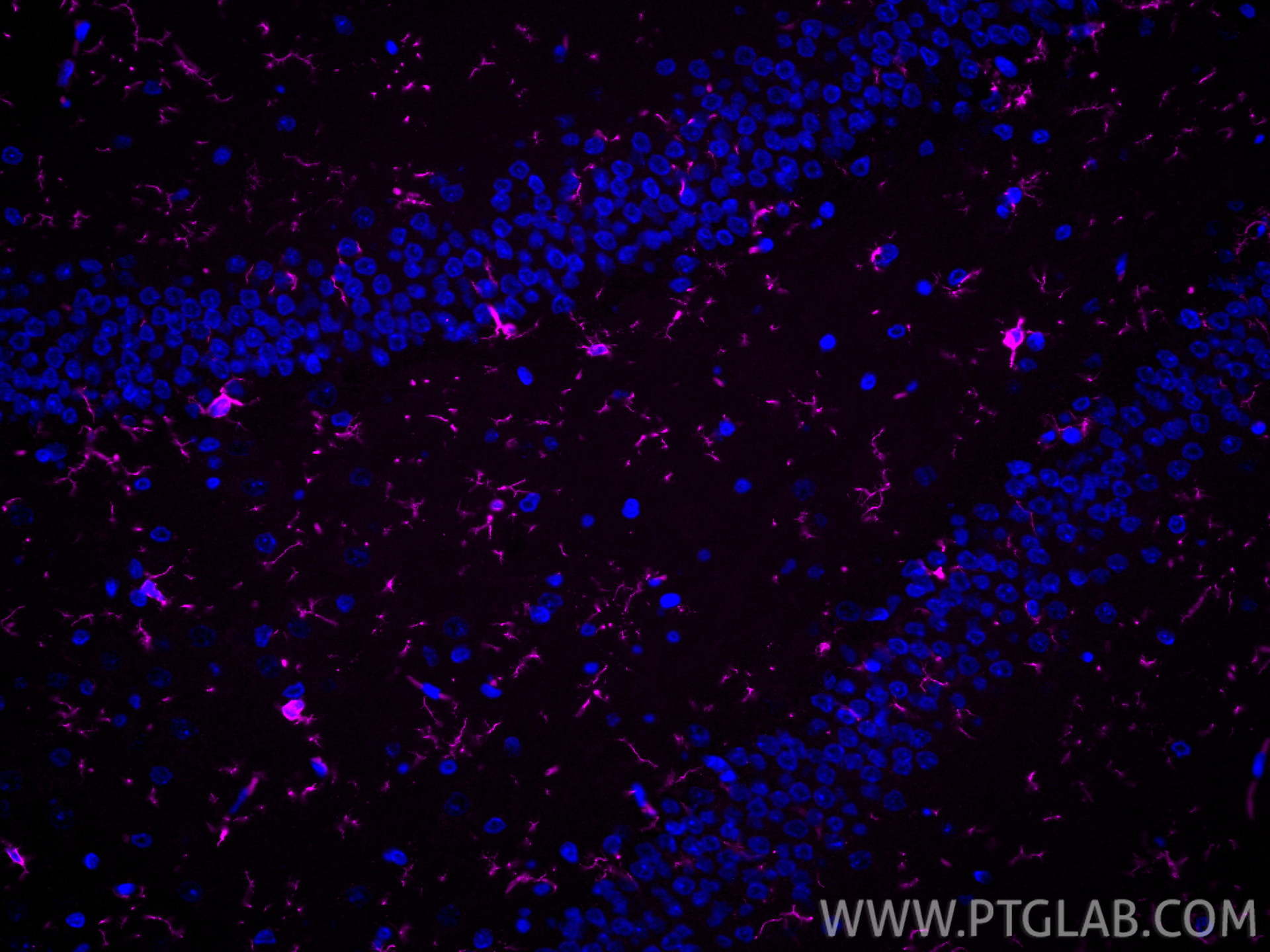Immunofluorescence (IF) / fluorescent staining of rat brain tissue using CoraLite® Plus 647-conjugated IBA1 Recombinant ant (CL647-81728)
