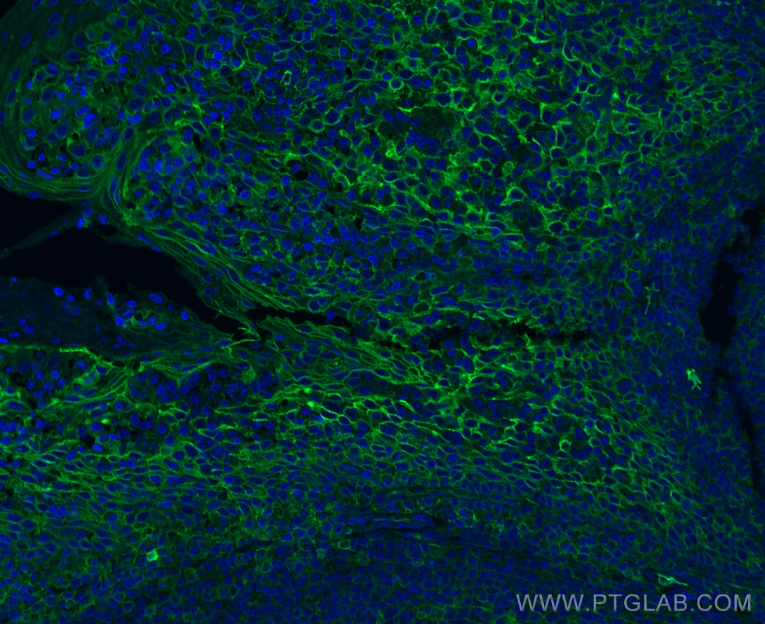 Immunofluorescence (IF) / fluorescent staining of human tonsillitis tissue using ICAM-1/CD54 Polyclonal antibody (10831-1-AP)