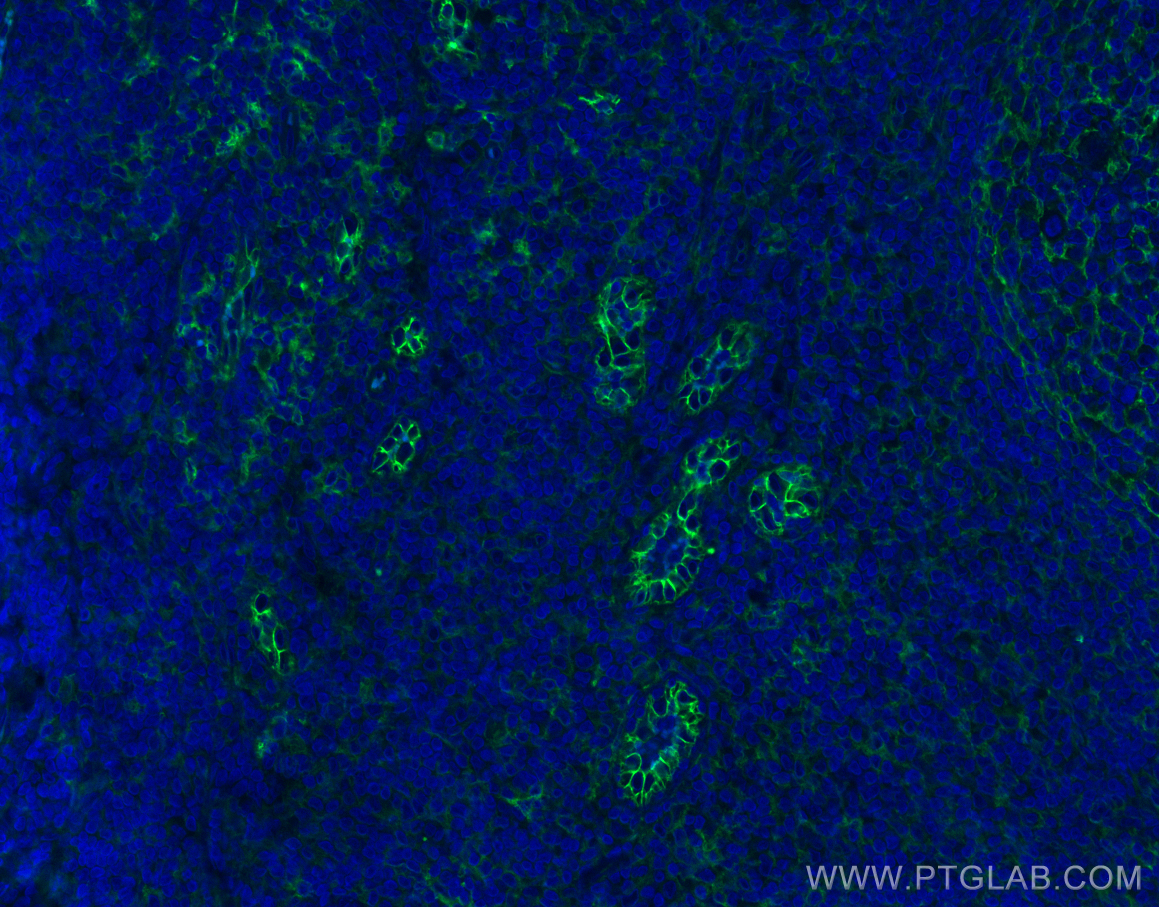 Immunofluorescence (IF) / fluorescent staining of human tonsillitis tissue using ICAM-1/CD54 Polyclonal antibody (10831-1-AP)