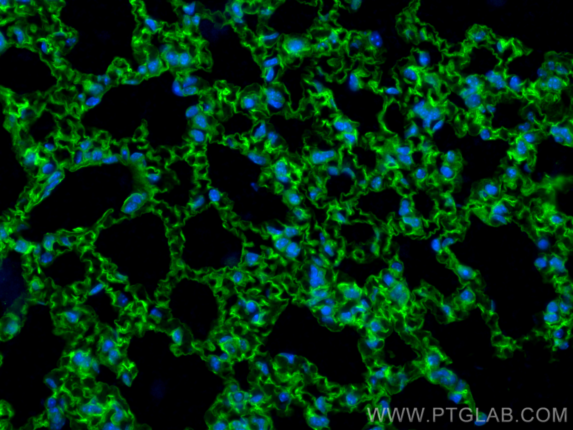 Immunofluorescence (IF) / fluorescent staining of mouse lung tissue using ICAM-1/CD54 Polyclonal antibody (16174-1-AP)