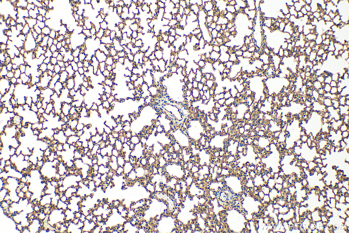 Immunohistochemistry (IHC) staining of mouse lung tissue using ICAM-1 Polyclonal antibody (16174-1-AP)