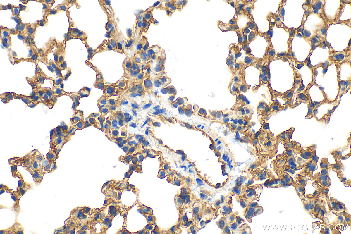 Immunohistochemistry (IHC) staining of mouse lung tissue using ICAM-1 Polyclonal antibody (16174-1-AP)