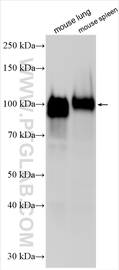 Western Blot (WB) analysis of various lysates using ICAM-1 Polyclonal antibody (16174-1-AP)