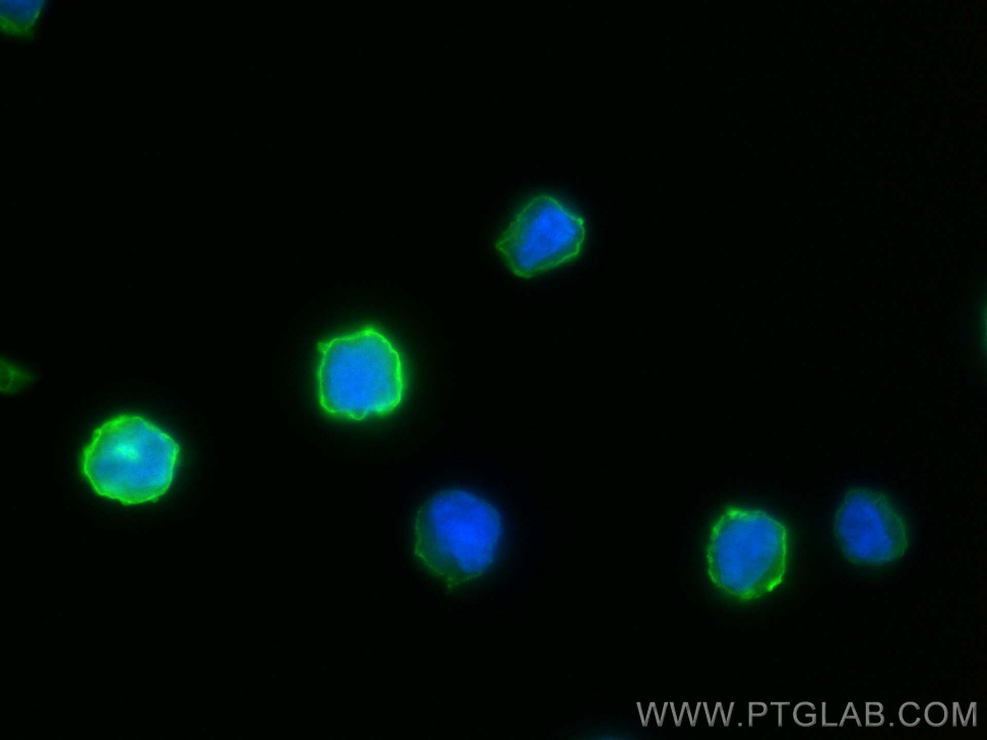 Immunofluorescence (IF) / fluorescent staining of Raji cells using ICAM-1 Polyclonal antibody (30806-1-AP)