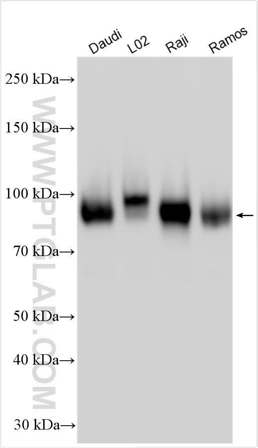 Western Blot (WB) analysis of various lysates using ICAM-1 Polyclonal antibody (30806-1-AP)