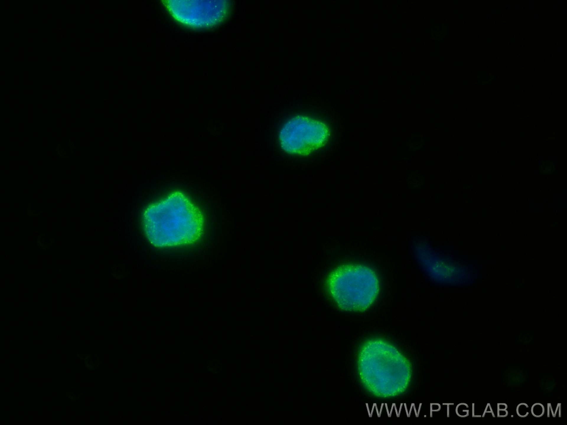 Immunofluorescence (IF) / fluorescent staining of Raji cells using ICAM-1 Monoclonal antibody (60299-1-Ig)