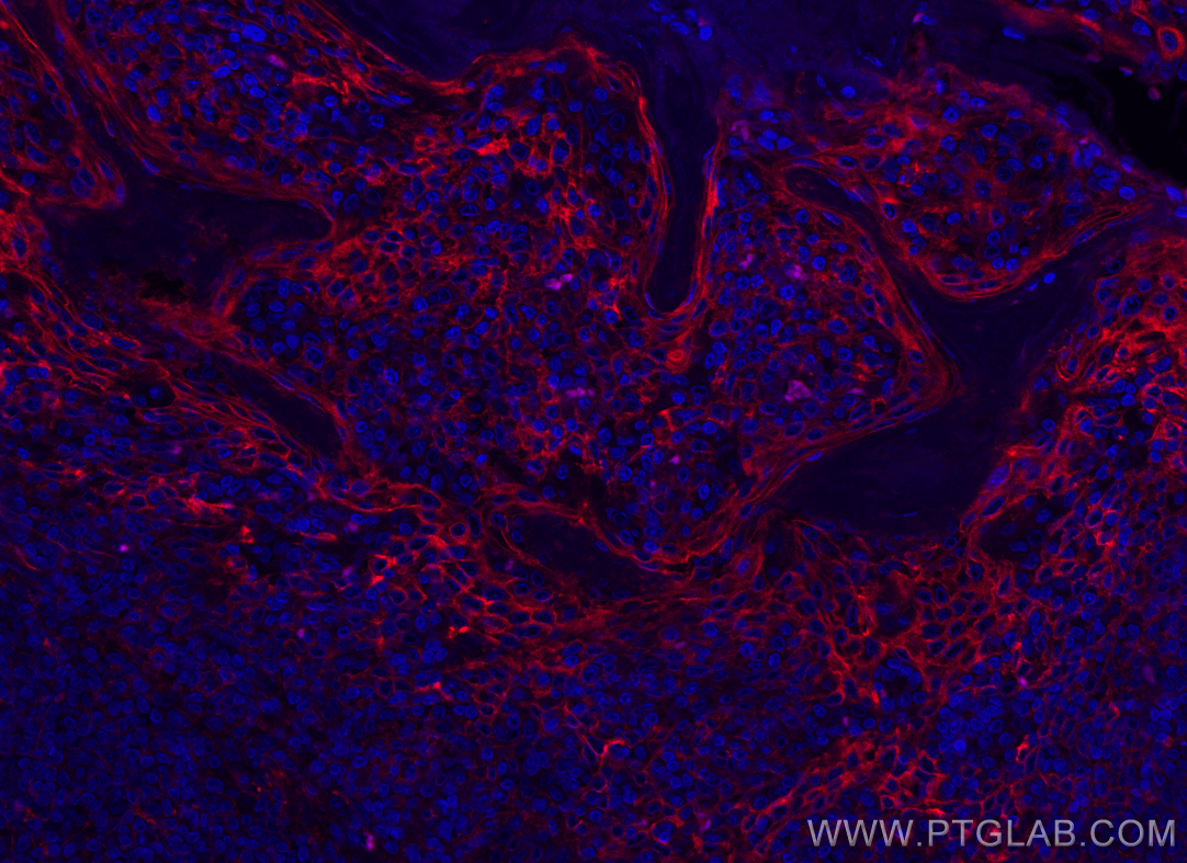 Immunofluorescence (IF) / fluorescent staining of human tonsillitis tissue using ICAM-1/CD54 Monoclonal antibody (60299-1-Ig)