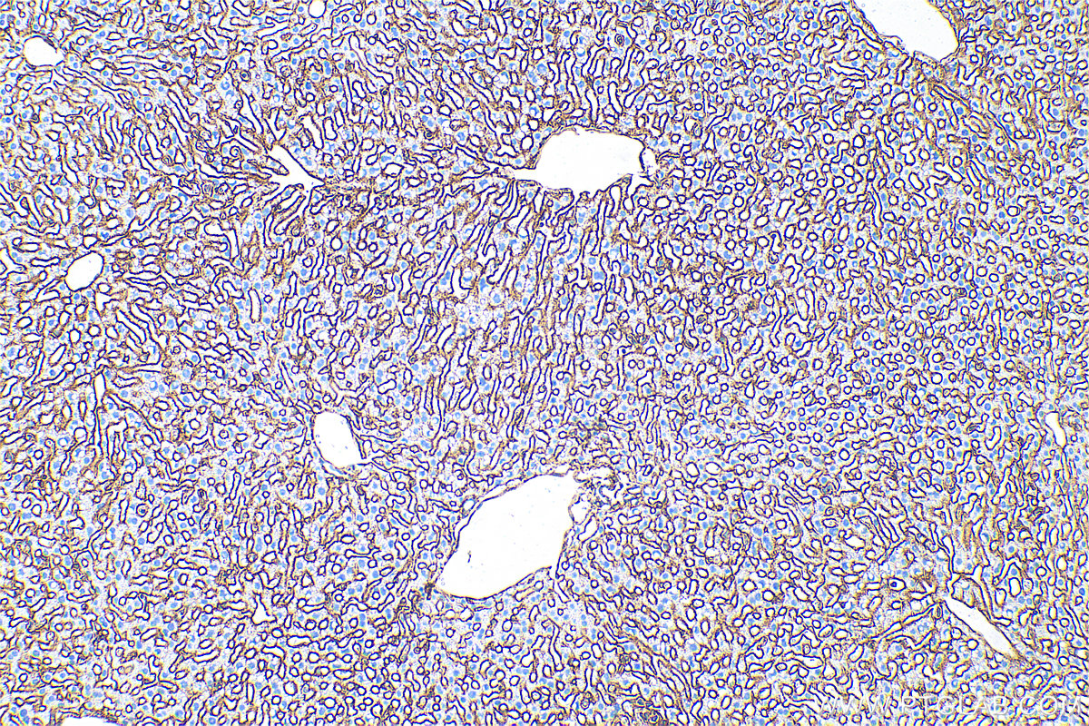 Immunohistochemistry (IHC) staining of mouse liver tissue using ICAM-1 Recombinant antibody (82827-1-RR)