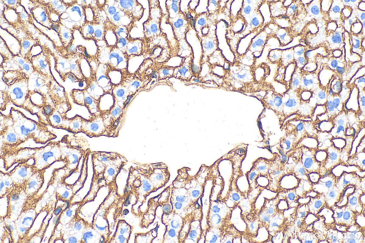 Immunohistochemistry (IHC) staining of mouse liver tissue using ICAM-1 Recombinant antibody (82827-1-RR)