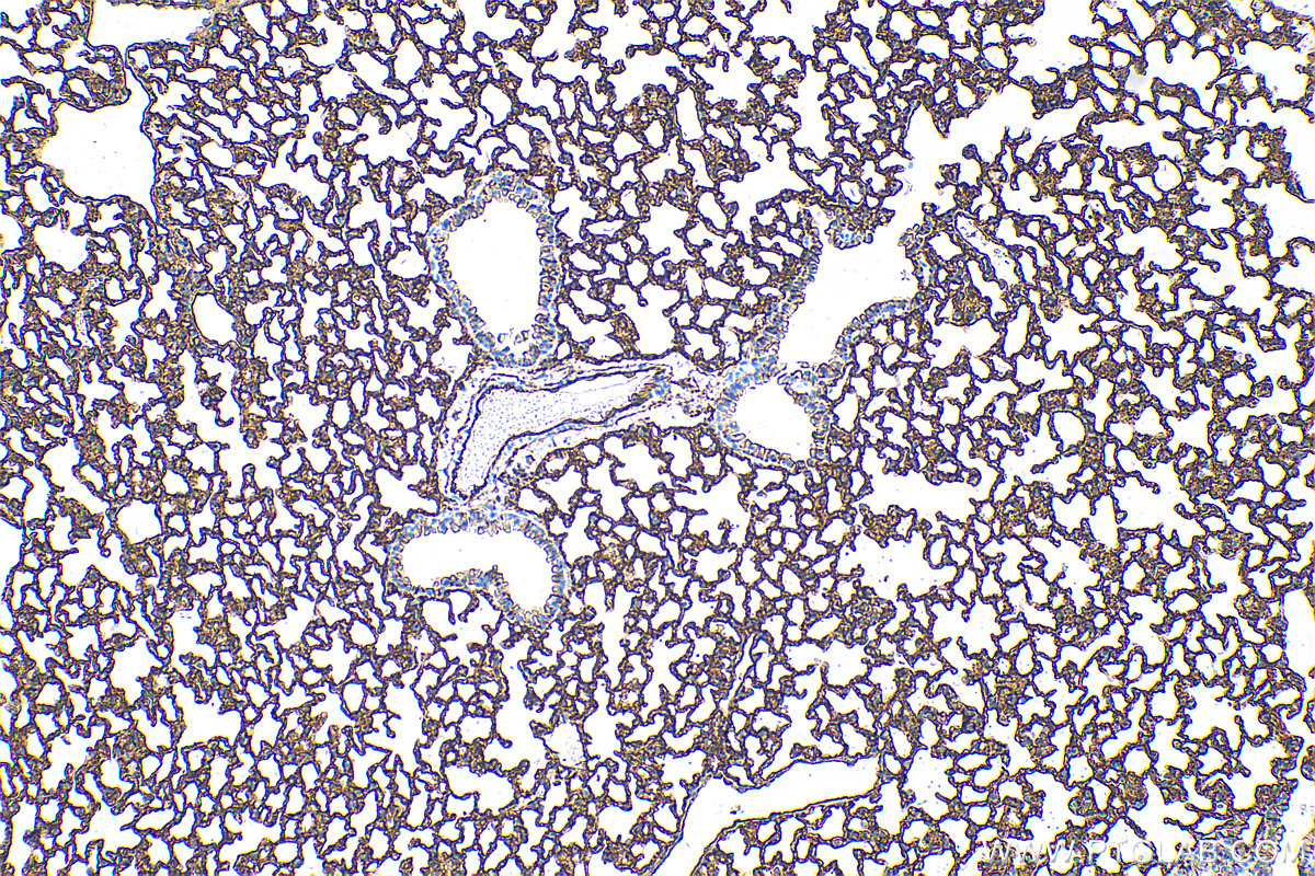 Immunohistochemistry (IHC) staining of mouse lung tissue using ICAM-1 Recombinant antibody (82827-1-RR)