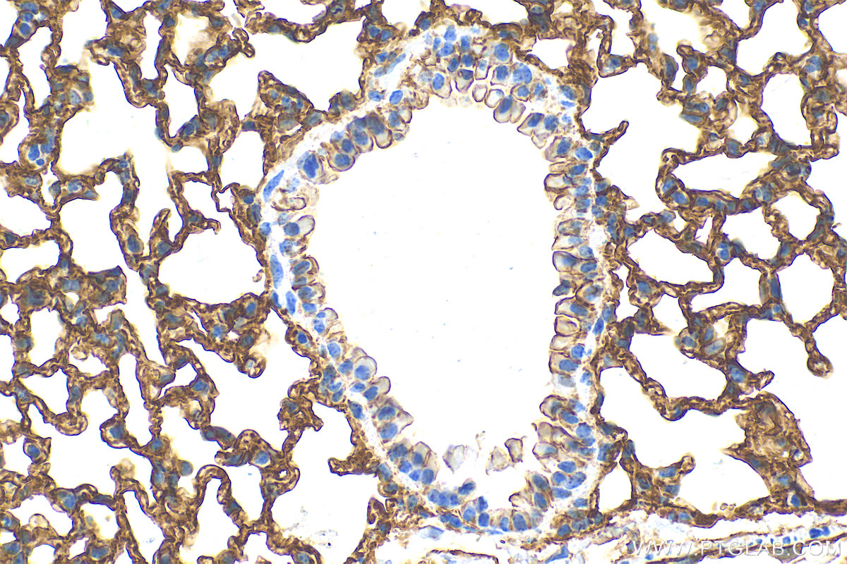 Immunohistochemistry (IHC) staining of mouse lung tissue using ICAM-1 Recombinant antibody (82827-1-RR)