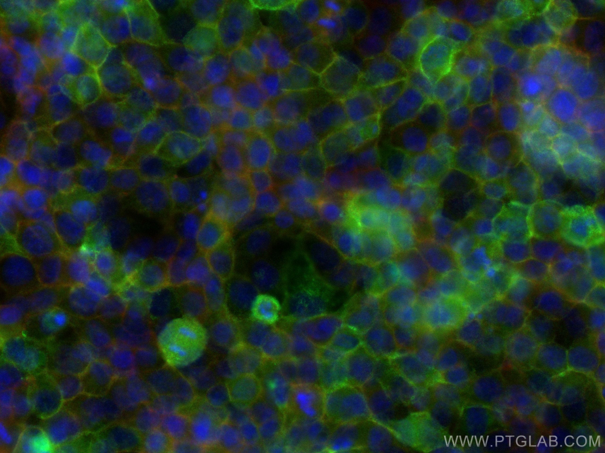 Immunofluorescence (IF) / fluorescent staining of HeLa cells using ICAM-1/CD54 Recombinant antibody (83069-6-RR)