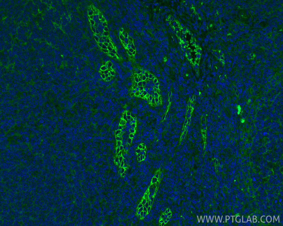 Immunofluorescence (IF) / fluorescent staining of human tonsillitis tissue using CoraLite® Plus 488-conjugated ICAM-1/CD54 Polyclon (CL488-10831)