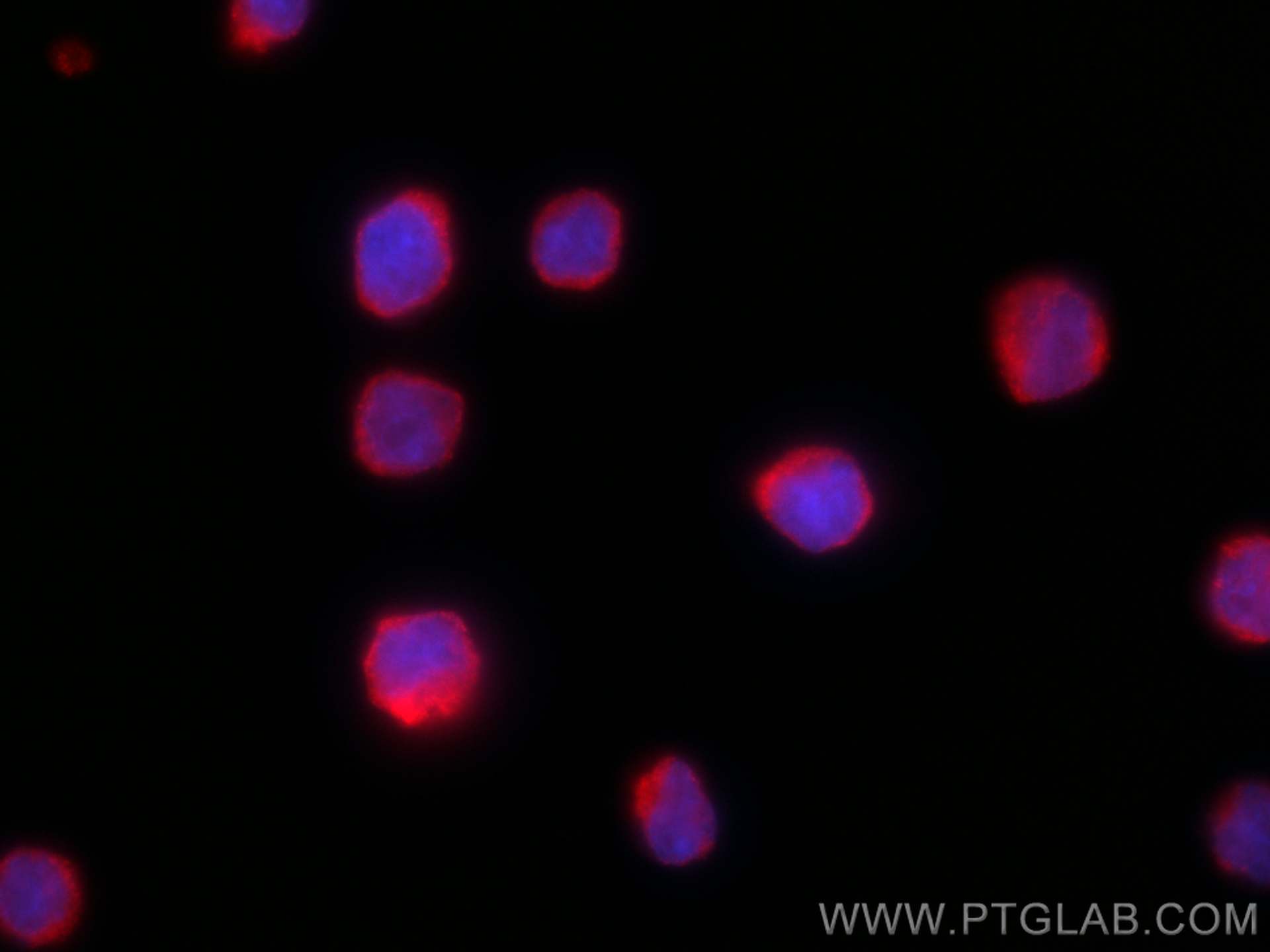 Immunofluorescence (IF) / fluorescent staining of Raji cells using CoraLite®594-conjugated ICAM-1 Monoclonal antibody (CL594-60299)