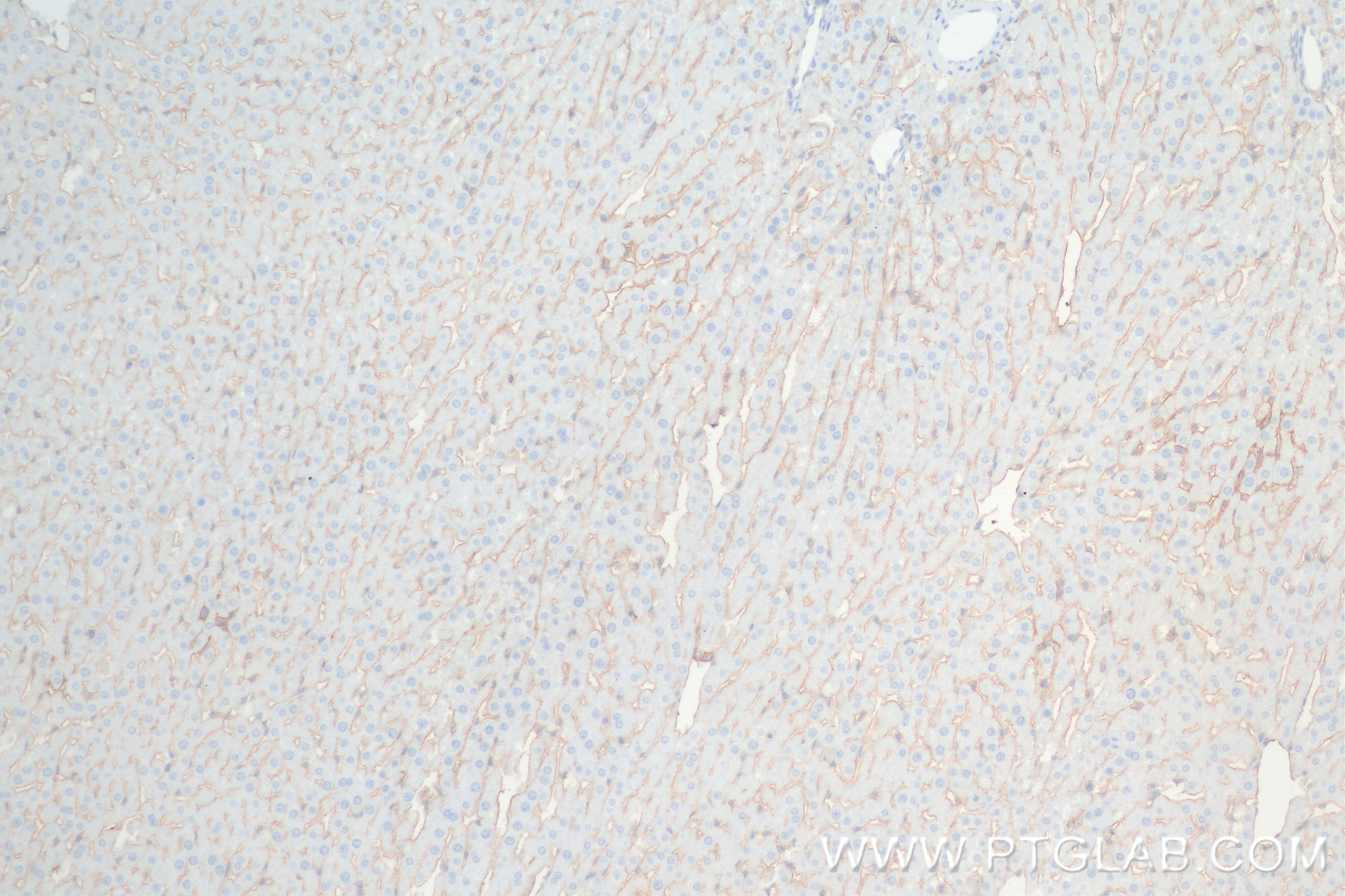 Immunohistochemistry (IHC) staining of rat liver tissue using ICAM-1/CD54 Recombinant antibody (83696-3-RR)