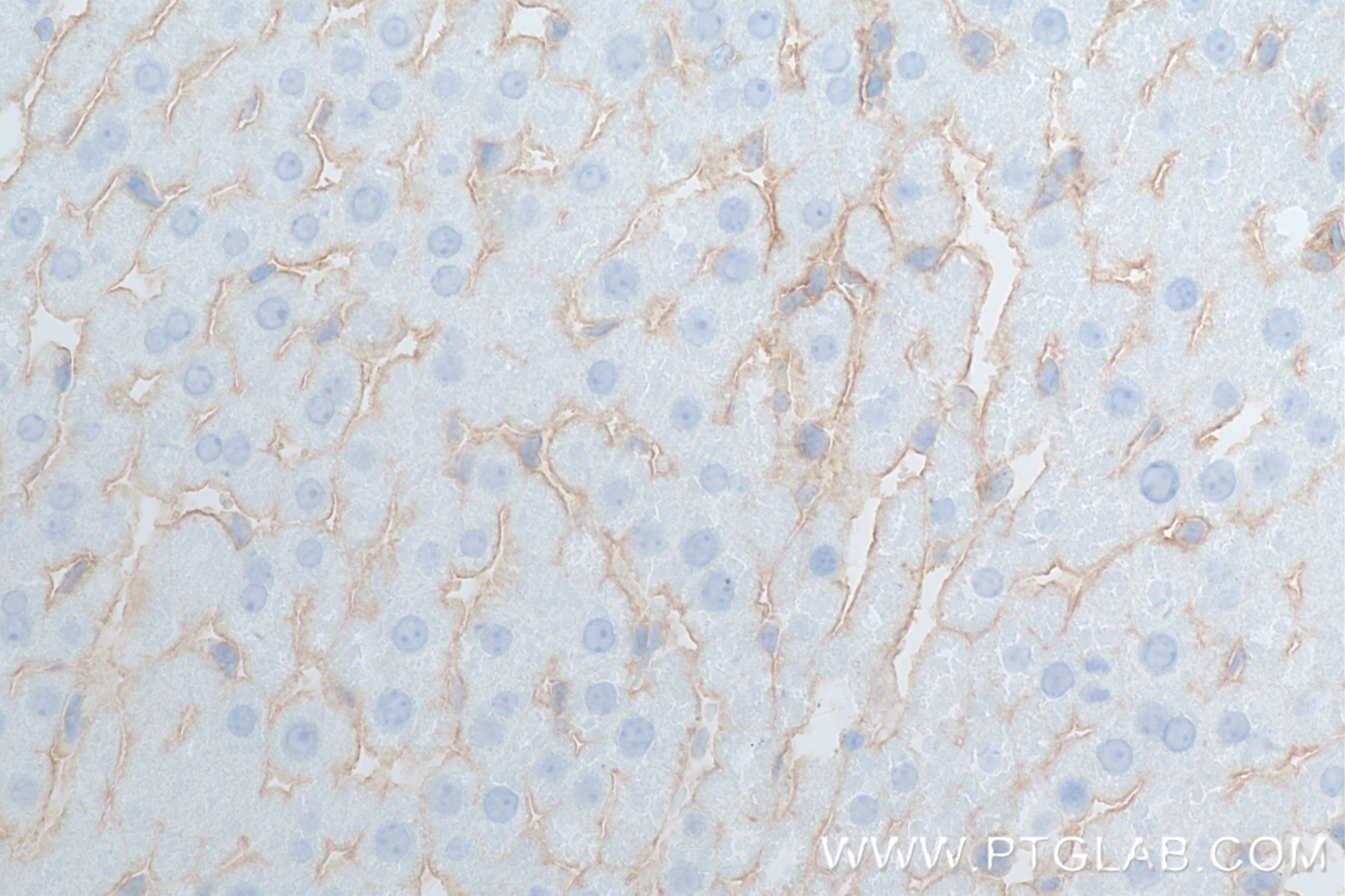 Immunohistochemistry (IHC) staining of rat liver tissue using ICAM-1/CD54 Recombinant antibody (83696-3-RR)