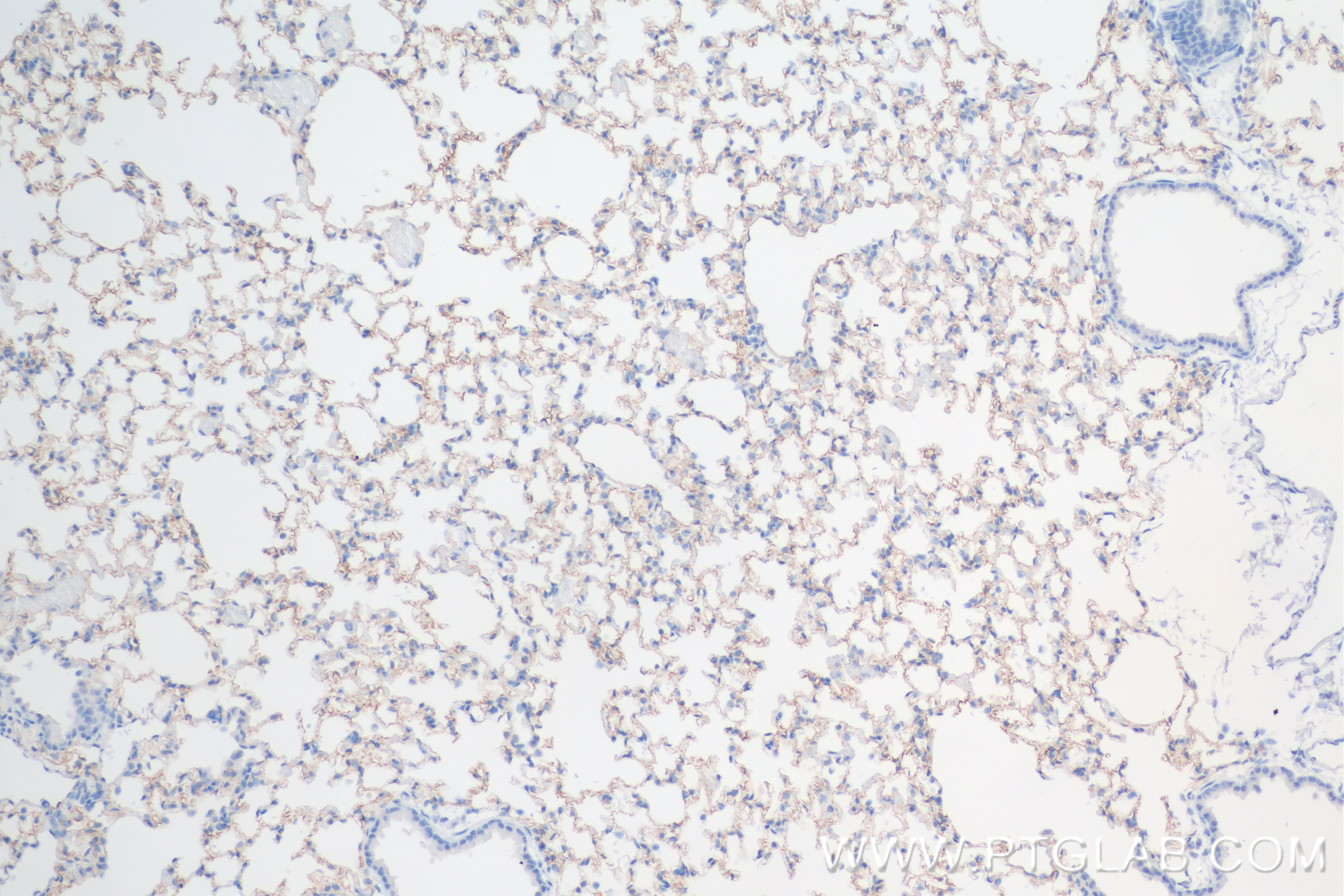 Immunohistochemistry (IHC) staining of rat lung tissue using ICAM-1/CD54 Recombinant antibody (83696-3-RR)