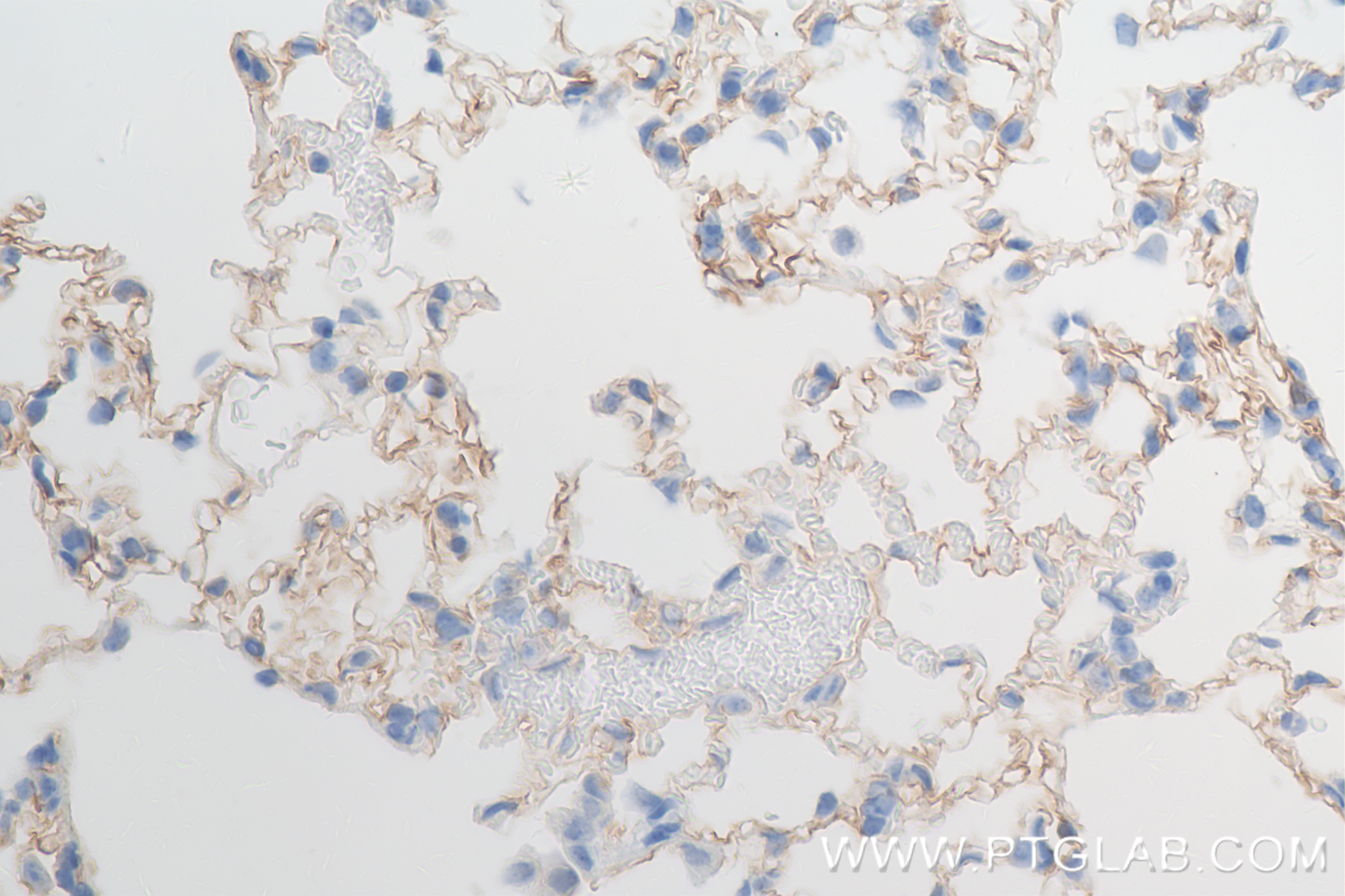 Immunohistochemistry (IHC) staining of rat lung tissue using ICAM-1/CD54 Recombinant antibody (83696-3-RR)