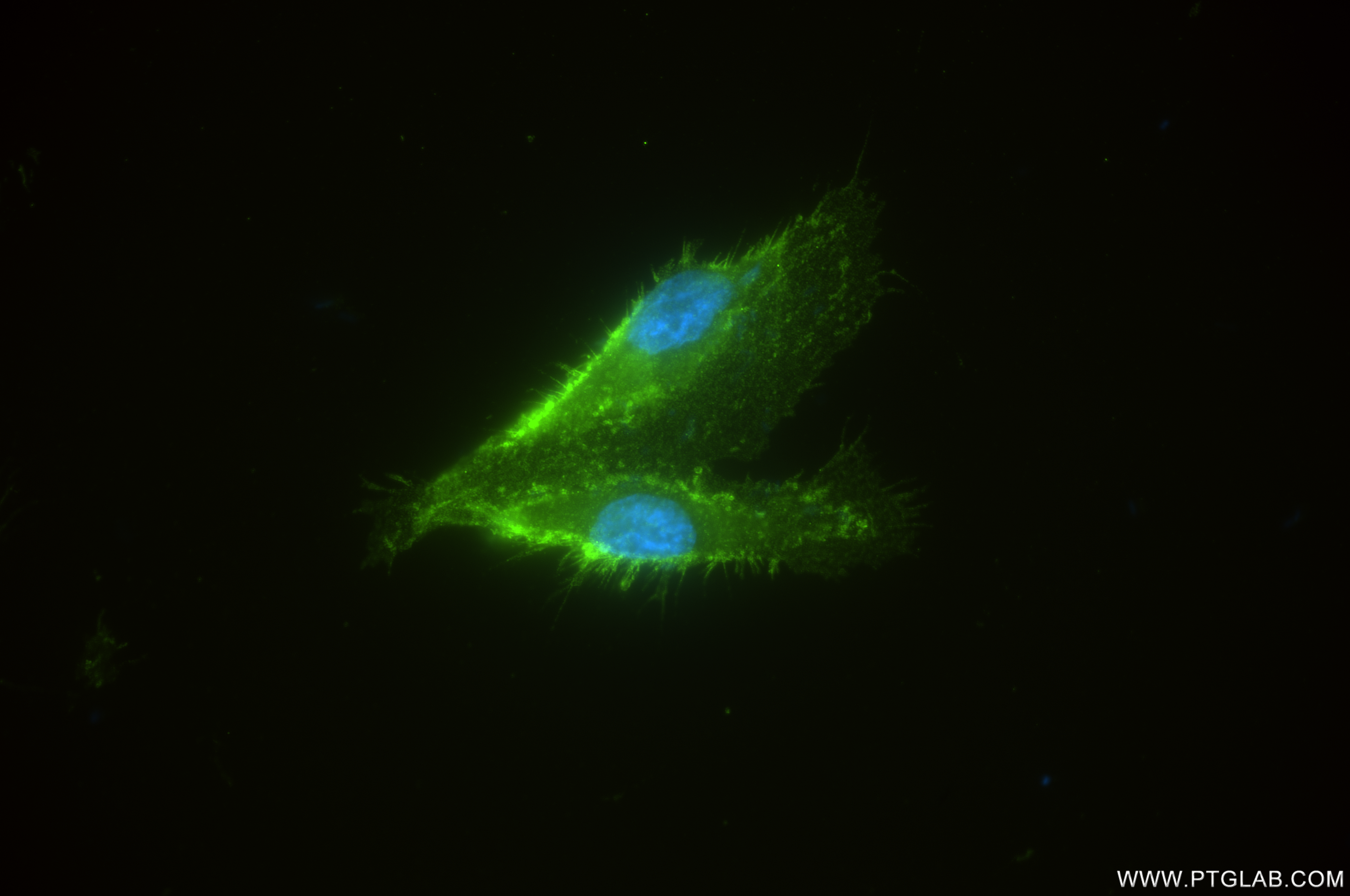 Immunofluorescence (IF) / fluorescent staining of HUVEC cells using ICAM-2/CD102 Recombinant antibody (84857-2-RR)