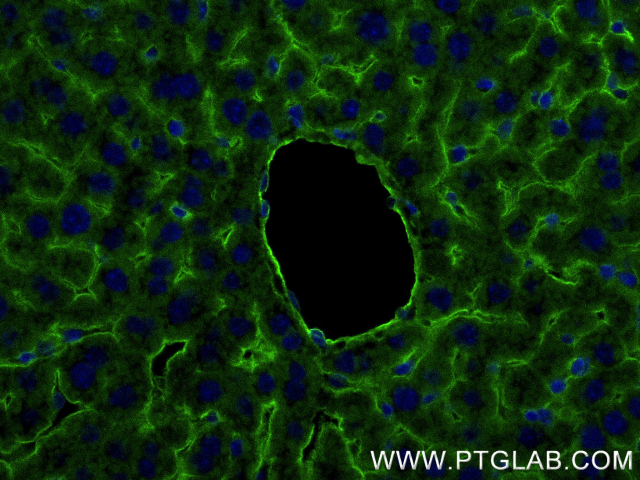 Immunofluorescence (IF) / fluorescent staining of mouse liver tissue using ICAM-1/CD54 Recombinant antibody (82827-8-RR)