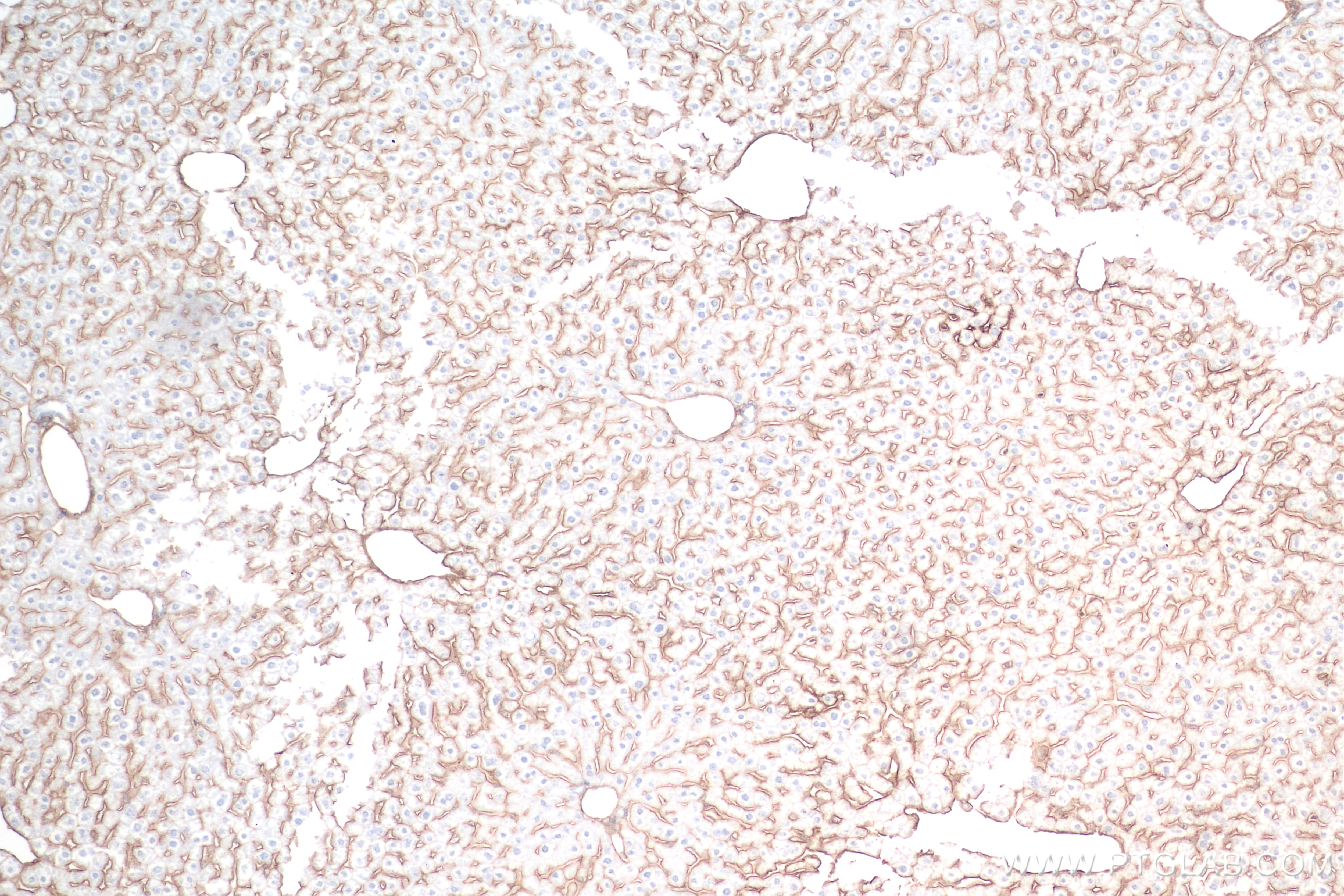 Immunohistochemistry (IHC) staining of mouse liver tissue using ICAM-1/CD54 Recombinant antibody (82827-8-RR)