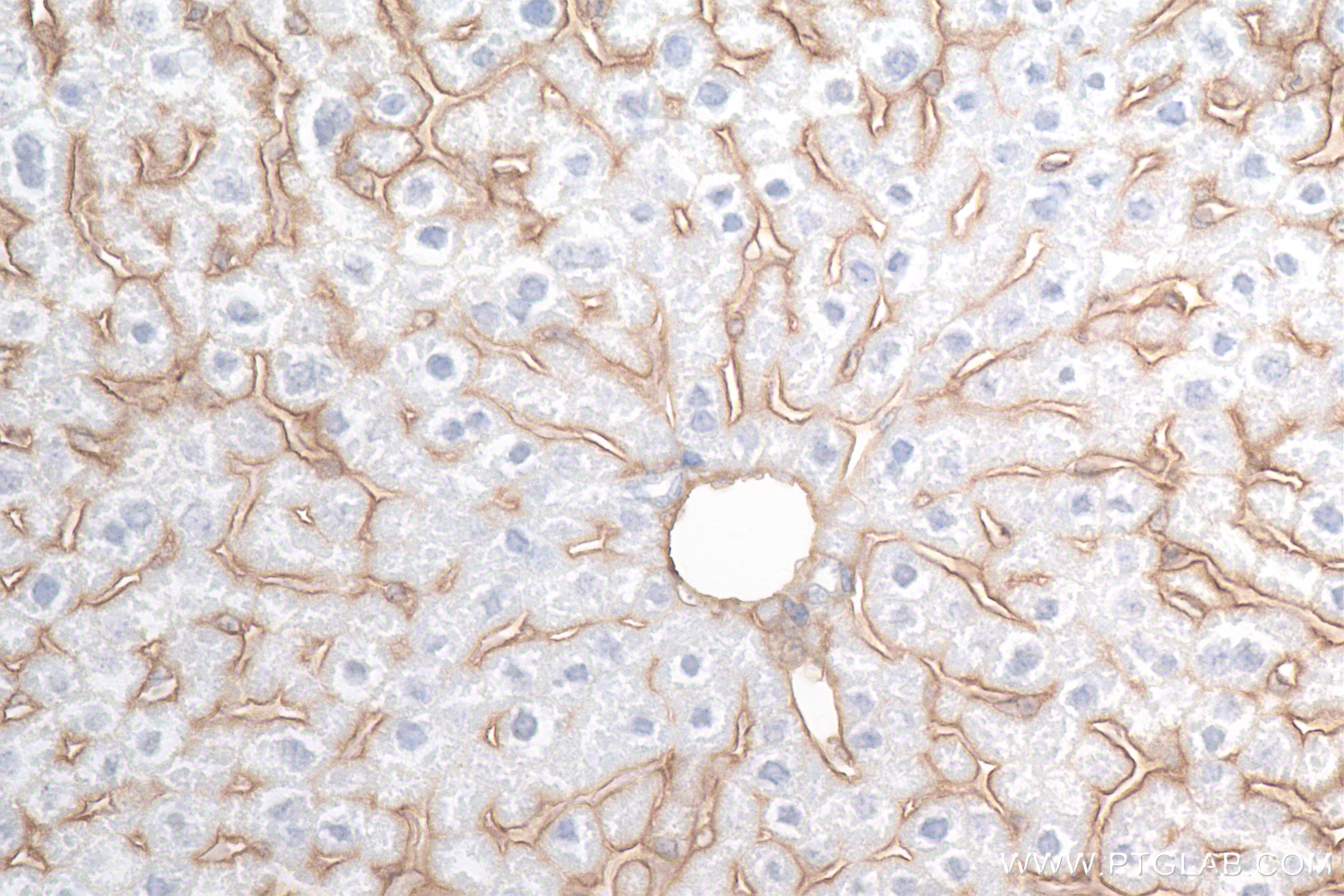 Immunohistochemistry (IHC) staining of mouse liver tissue using ICAM-1/CD54 Recombinant antibody (82827-8-RR)